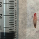 Illustration for article titled Here Is a Teeny Nail Growing on Top of Another Nail on Someones Middle Finger